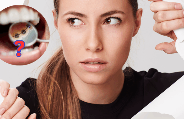 Alternatives to InBrace and Lingual Braces