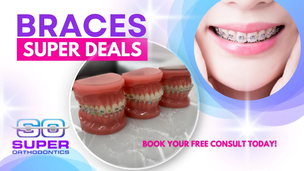 Braces Super Deals by Super Orthodontics