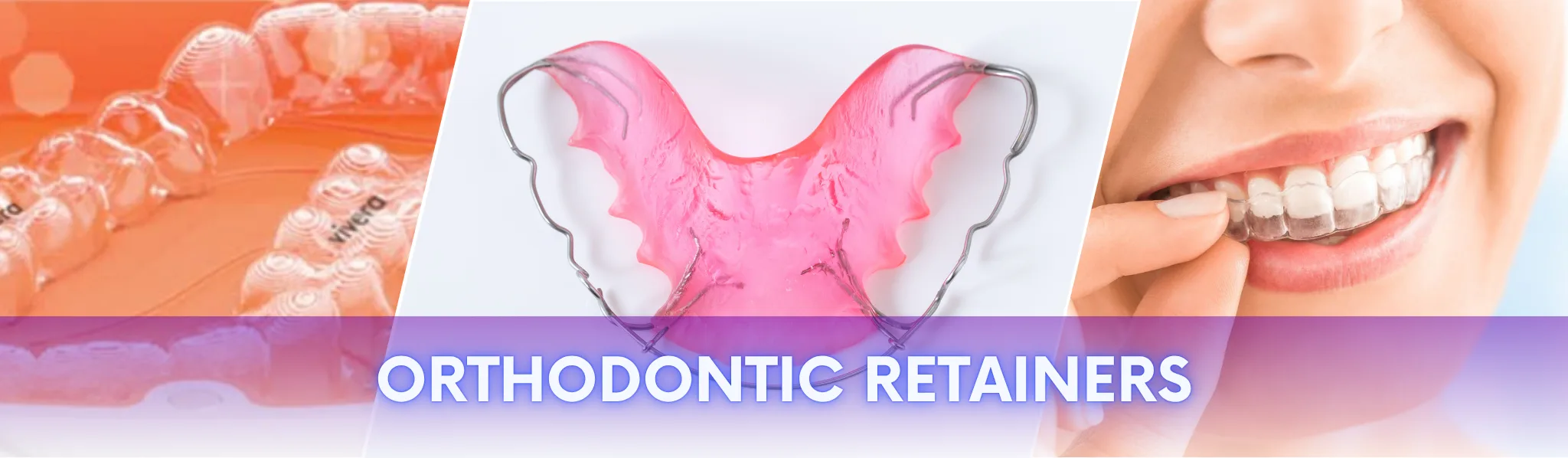 Essix Retainers, Hawley Retainers, Fixed Retainers by Super Orthodontics in Encino, Los Angeles and Nearby neighborhoods Essix Retainers, Hawley Retainers, Fixed Retainers by Super Orthodontics in Encino, Los Angeles and Nearby neighborhoods