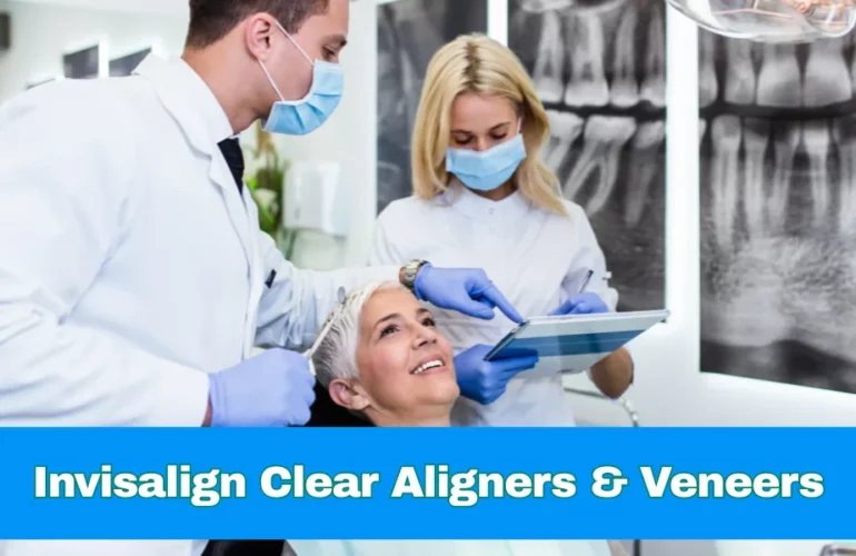 Comprehensive guide to getting Invisalign or clear aligners when you already have veneers, Encino, Los Angeles, and nearby areas